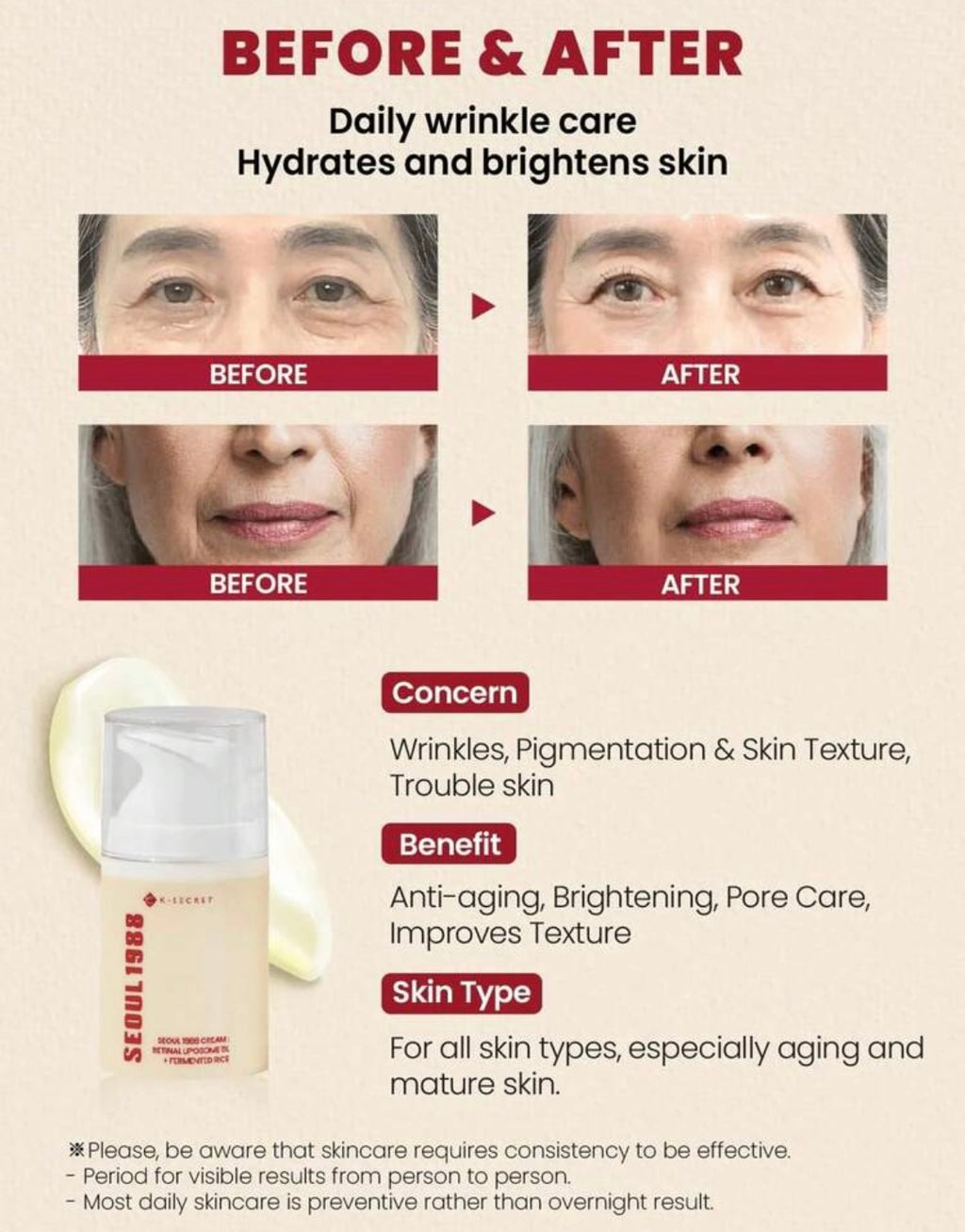✨ SEOUL 1988 Retinal Cream – Radiance in Every Drop